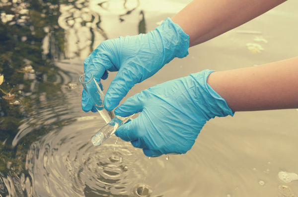 Cholera Water being tested for cholera